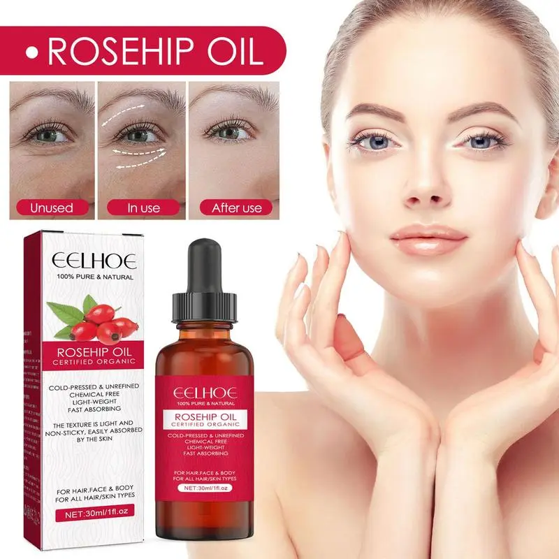 Cold Pressed Rose Hip - 30ml Organic Rosehip Seed Oil For