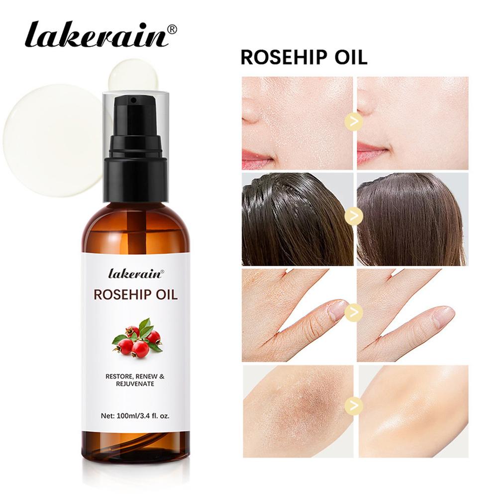 Rosehip Oil For Face & Skin Or - đánh giá và giá Cold Pressed Rose Hip